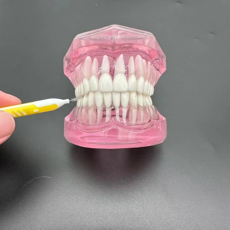 Overmolded Type I Interdental Brush
