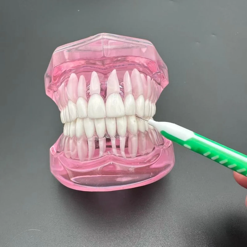Overmolded Type I Interdental Brush